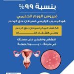 الصحة:فيروس الورم الحليمي هو المسبب الرئيسي لسرطان عنق الرحم بنسبة ٩٩٪؜