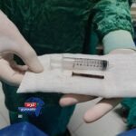 إنجاز طبي جديد بجامعة الزقازيق.. استخراج «مسمار معدني بطول 10 سم» من طفلة دون جراحة إنجاز طبي جديد بجامعة الزقازيق.. استخراج «مسمار معدني بطول 10 سم» من طفلة دون جراحة