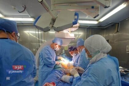 استئصال دوالي الساقين بالتردد الحراري